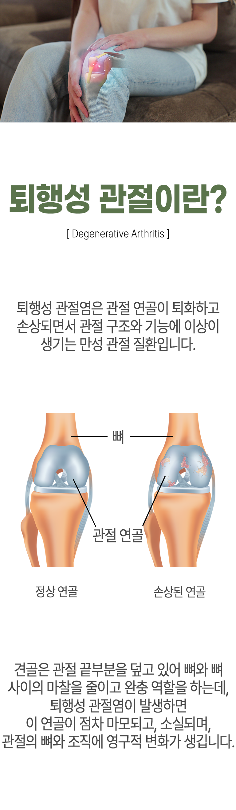 퇴행성 관절이란? ▷ 퇴행성 관절염은 관절 연골이 퇴화하고 손상되면서 관절 구조와 기능에 이상이 생기는 만성 관절 질환입니다. 견골은 관절 끝부분을 덮고 있어 뼈와 뼈 사이의 마찰을 줄이고 완충 역할을 하는데, 퇴행성 관절염이 발생하면 이 연골이 점차 마모되고, 소실되며, 관절의 뼈와 조직에 영구적 변화가 생깁니다.