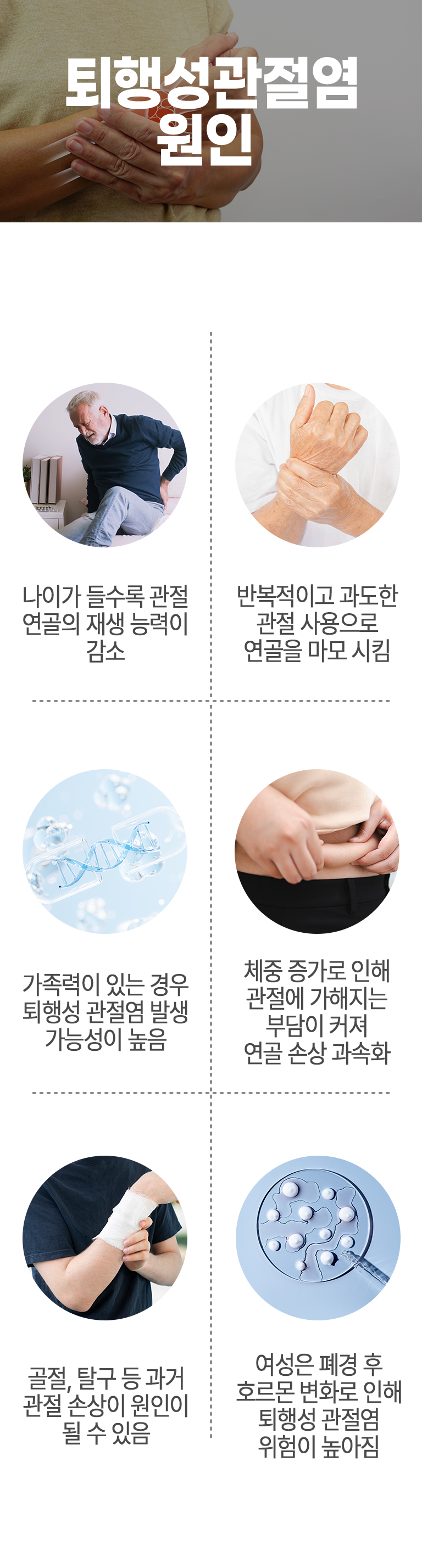 퇴행성관절염 원인 ▷ 나이가 들수록 관절 연골의 재생 능력이 감소, 반복적이고 과도한 관절 사용으로 연골을 마모 시킴, 가족력이 있는 경우 퇴행성 관절염 발생 가능성이 높음, 체중 증가로 인해 관절에 가해지는 부담이 커져 연골 손상 과속화, 골절, 탈구 등 과거 관절 손상이 원인이 될 수 있음, 여성은 폐경 후 호르몬 변화로 인해 퇴행성 관절염 위험이 높아짐