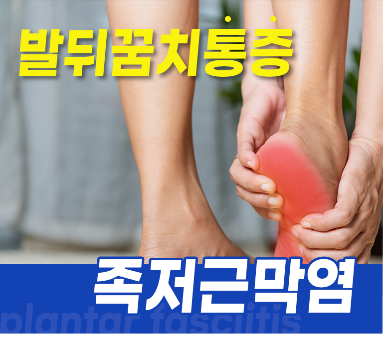발뒤꿈치통증 족저근막염.