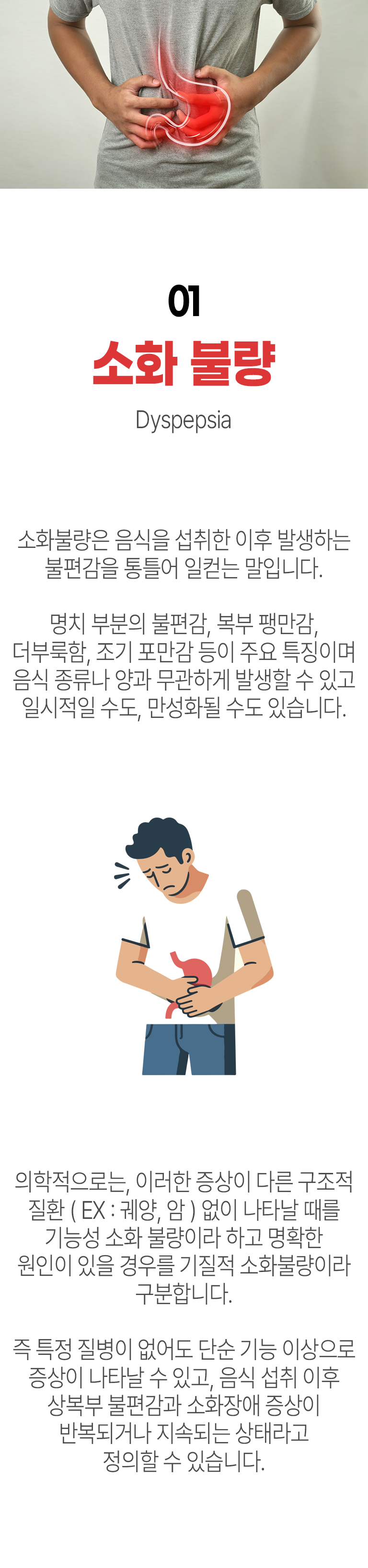 01 소화 불량 ▷ 소화불량은 음식을 섭취한 이후 발생하는 불편감을 통틀어 일컫는 말입니다. 명치 부분의 불편감, 복부 팽만감, 더부룩함, 조기 포만감 등이 주요 특징이며 음식 종류나 양과 무관하게 발생할 수 있고 일시적일 수도, 만성화될 수도 있습니다. 의학적으로는 이러한 증상이 다른 구조적 질환(EX:궤양, 암) 없이 나타날 때를 기능성 소화 불량이라 하고 명확한 원인이 있을 경우를 기질적 소화불량이라 구분합니다. 즉 특정 질병이 없어도 단순 기능 이상으로 증상이 나타날 수 있고, 음식 섭취 이후 상복부 불편감과 소화장애 증상이 반복되거나 지속되는 상태라고 정의할 수 있습니다.