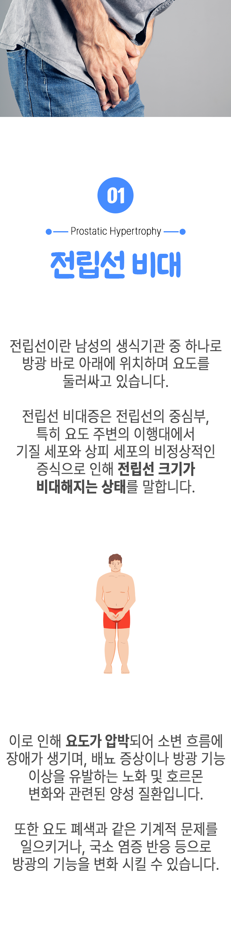 01 전립선 비대 ▷ 전립선이란 남성의 생식기관 중 하나로 방광 바로 아래에 위치하며 요도를 둘러싸고 있습니다. 전립선 비대증은 전립선의 중심부, 특히 요도 주변의 이행대에서 기질 세포와 상피 세포의 비정상적인 증식으로 인해 전립선 크기가 비대해지는 상태를 말합니다. 이로 인해 요도가 압박되어 소변 흐름에 장애가 생기며, 배뇨 증상이나 방광 기능 이상을 유발하는 노화 및 호르몬 변화와 관련된 양성 질환입니다. 또한 요도 폐색과 같은 기계적 문제를 일으키거나, 국소 염증 반응 등으로 방광의 기능을 변화 시킬 수 있습니다.