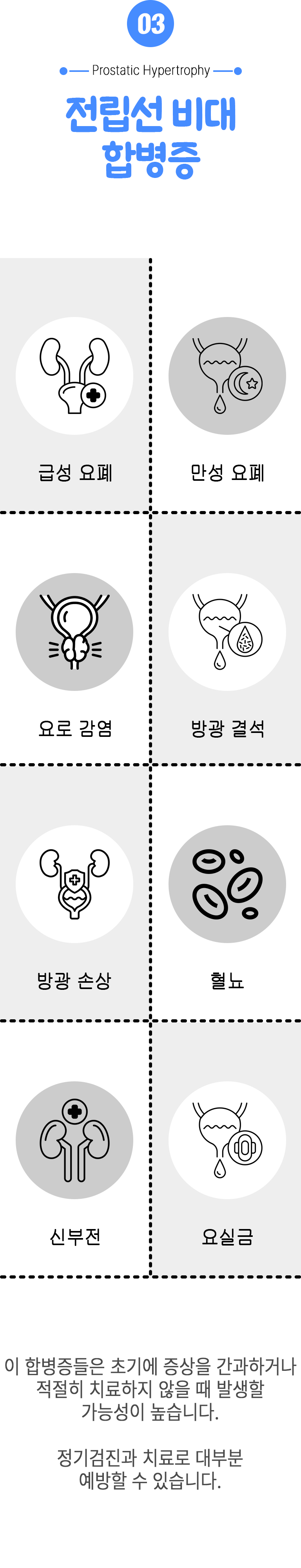 03 전립선 비대 합병증 ▷ 급성 요폐, 만성 요폐, 요로 감염, 방광 결석, 방광 손상, 혈뇨, 신부전, 요실금. 이 합병증들은 초기에 증상을 간과하거나 적절히 치료하지 않을 때 발생할 가능성이 높습니다. 정기검진과 치료로 대부분 예방할 수 있습니다.