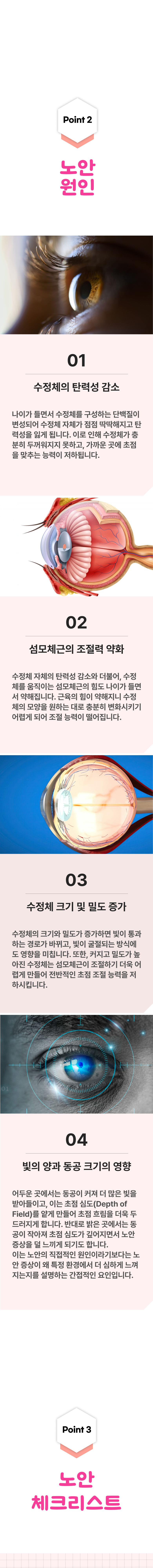 노안 2