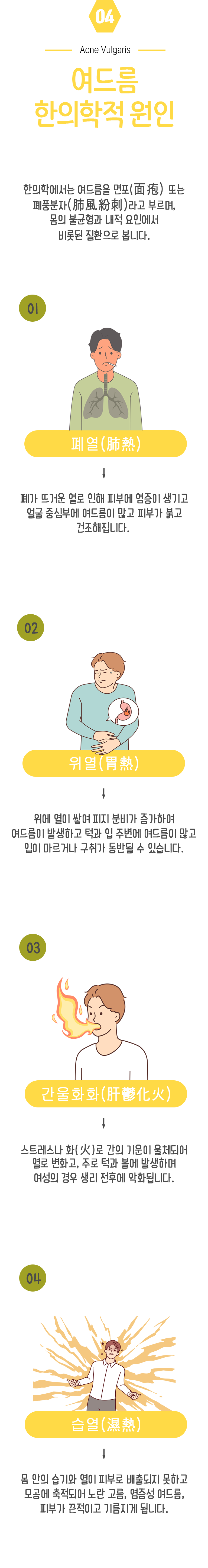 04 여드름 한의학적 원인 ▷ 한의학에서는 여드름을 면포(面疱) 또는 폐풍분자(肺風紛刺)라고 부르며, 몸의 불균형과 내적 요인에서 비롯된 질환으로 봅니다. 1. 폐열(肺熱) - 폐가 뜨거운 열로 인해 피부에 염증이 생기고 얼굴 중심부에 여드름이 많고 피부가 붉고 건조해집니다. 2. 위열(胃熱) - 위에 열이 쌓여 피지 분비가 증가하여 여드름이 발생하고 턱과 입 주변에 여드름이 많고 입이 마르거나 구취가 동반될 수 있습니다. 3. 간울화화(肝鬱化火) - 스트레스나 화(火)로 간의 기운이 울체되어 열로 변화고, 주로 턱과 볼에 발생하여 여성의 경우 생리 전후에 악화됩니다. 4. 습열(濕熱) - 몸 안의 습기와 열이 피부로 배출되지 못하고 모공에 축적되어 노란 고름, 염증성 여드름, 피부가 끈적이고 기름지게 됩니다.