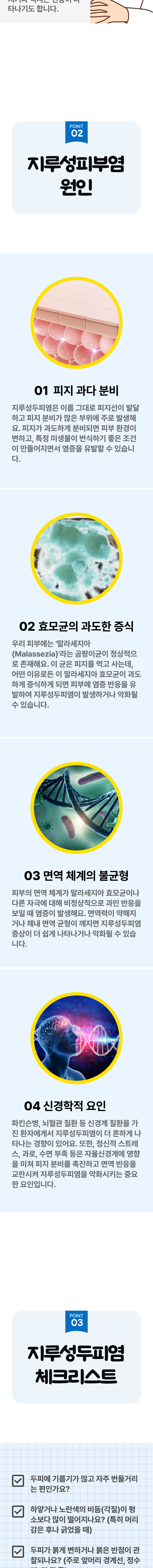 지루성두피염 2