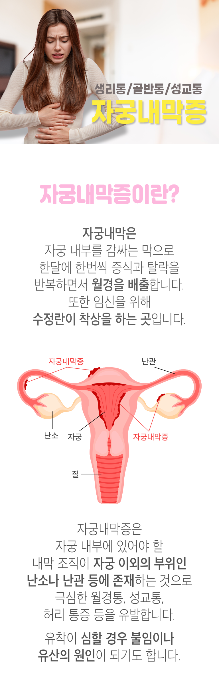 생리통/골반통/성교통 자궁내막증. 자궁내막증이란? ▷ 자궁내막은 자궁 내부를 감싸는 막으로 한달에 한번씩 증식과 탈락을 반복하면서 월경을 배출합니다. 또한 임신을 위해 수정란이 착상을 하는 곳입니다. 자궁내막증은 자궁 내부에 있어야 할 내막 조직이 자궁 이외의 부위인 난소나 난관 등에 존재하는 것으로 극심한 월경통, 성교통, 허리 통증 등을 유발합니다. 유착이 심할 경우 불임이나 유산의 원인이 되기도 합니다.