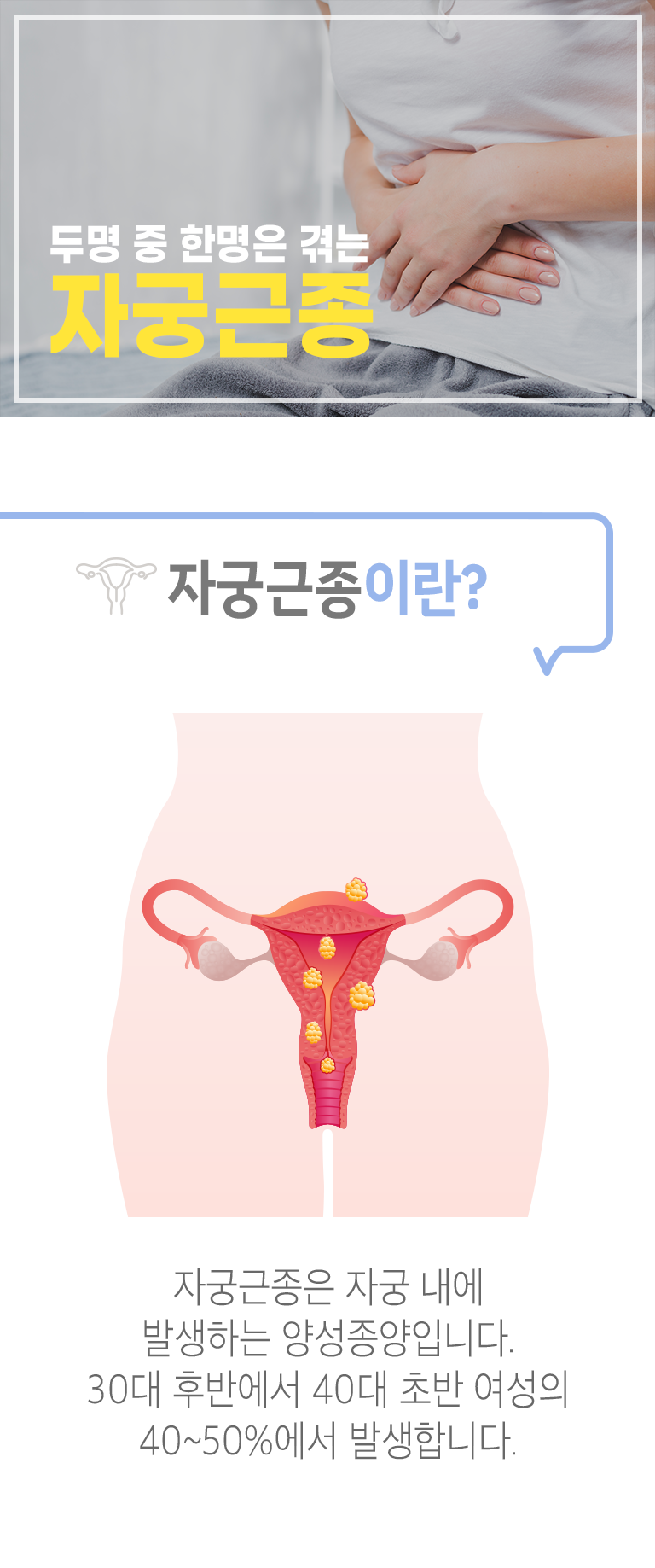 두명 중 한명은 겪는 자궁근종. 자궁근종이란? ▷ 자궁근종은 자궁 내에 발생하는 양성종양입니다. 30대 후반에서 40대 초반 여성의 40~50%에서 발생합니다.